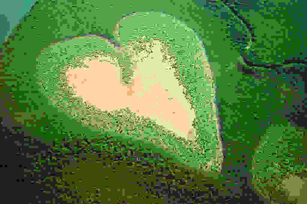 5147624881 39f5980572 b