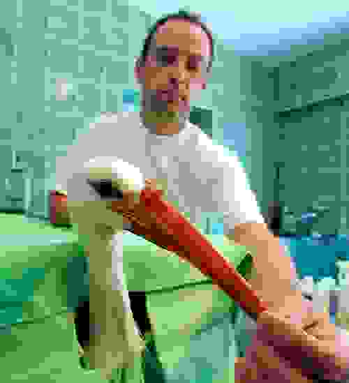 prosthetic6