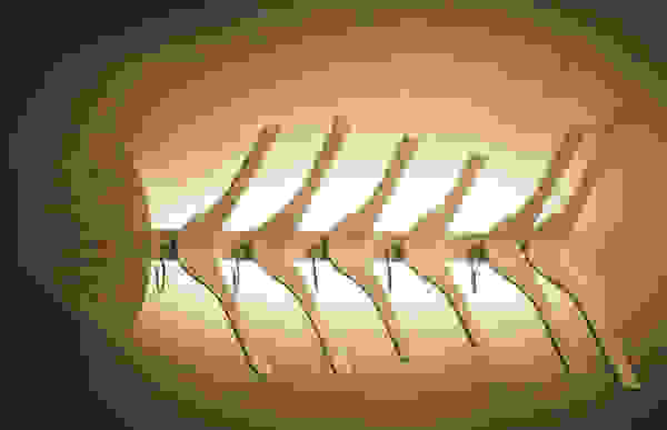 light4