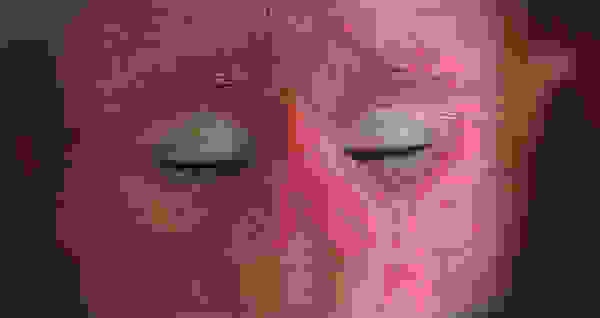 uakari7