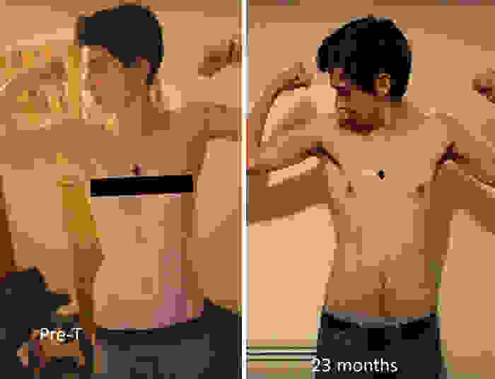 gender-transition-timelapse-video-3-years-selfies-jamie-raines-17.jpg