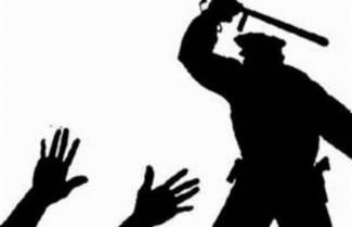 Ξυλοδαρμός Αφρικανού από αστυνομικούς της ΜΜΑΔ στην Κύπρο (video)