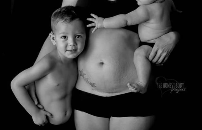 «The Honest Body Project»