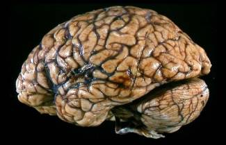 Εγκέφαλος: αλήθειες και μύθοι για το πιο παράξενο όργανο του σώματός μας!