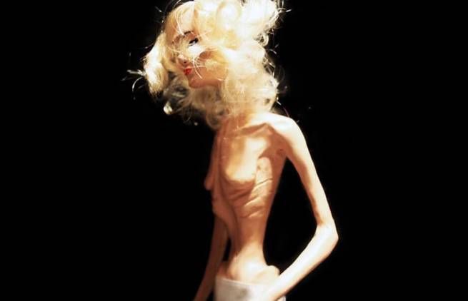 Eάν η Barbie ήταν υπαρκτό πρόσωπο θα ήταν ανορεξική